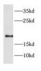 Defender Against Cell Death 1 antibody, FNab02232, FineTest, Western Blot image 