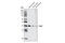SRY-Box 1 antibody, 4194S, Cell Signaling Technology, Western Blot image 