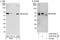 Probable ATP-dependent RNA helicase DDX56 antibody, A302-978A, Bethyl Labs, Immunoprecipitation image 