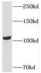 Ubiquitin Specific Peptidase 33 antibody, FNab09326, FineTest, Western Blot image 