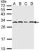 Proteasome Subunit Alpha 6 antibody, LS-C186310, Lifespan Biosciences, Western Blot image 