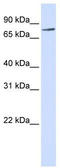 Receptor Interacting Serine/Threonine Kinase 4 antibody, TA338941, Origene, Western Blot image 