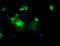 L1 Cell Adhesion Molecule antibody, NBP2-02149, Novus Biologicals, Immunocytochemistry image 