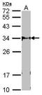 F-Box And Leucine Rich Repeat Protein 12 antibody, TA308590, Origene, Western Blot image 
