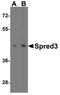 Sprouty Related EVH1 Domain Containing 3 antibody, NBP2-41091, Novus Biologicals, Western Blot image 