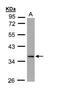 Dual Specificity Phosphatase 9 antibody, NBP1-31227, Novus Biologicals, Western Blot image 