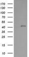 Parvin Alpha antibody, TA505991BM, Origene, Western Blot image 