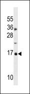 CDKN2A antibody, LS-C159868, Lifespan Biosciences, Western Blot image 