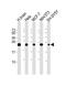 Superoxide Dismutase 2 antibody, M33970-1, Boster Biological Technology, Western Blot image 