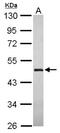 ACS antibody, NBP2-17192, Novus Biologicals, Western Blot image 