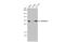 ATPase H+ Transporting V1 Subunit E1 antibody, GTX114056, GeneTex, Western Blot image 
