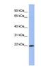 RNA Binding Motif Protein 38 antibody, NBP1-57503, Novus Biologicals, Western Blot image 