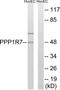 Protein phosphatase 1 regulatory subunit 7 antibody, TA312032, Origene, Western Blot image 