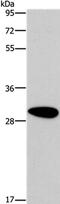 Dimethylarginine Dimethylaminohydrolase 2 antibody, PA5-50649, Invitrogen Antibodies, Western Blot image 