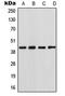 NPHS2 Stomatin Family Member, Podocin antibody, MBS821292, MyBioSource, Western Blot image 