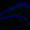 GFAP antibody, HPA056030, Atlas Antibodies, Immunohistochemistry paraffin image 