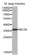 Melanocortin 3 Receptor antibody, STJ27686, St John