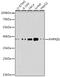 Protein Kinase AMP-Activated Non-Catalytic Subunit Beta 1 antibody, GTX57162, GeneTex, Western Blot image 