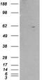 Retinoid X Receptor Beta antibody, NB100-1467, Novus Biologicals, Western Blot image 