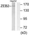 Zinc Finger E-Box Binding Homeobox 2 antibody, PA5-38536, Invitrogen Antibodies, Western Blot image 