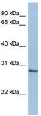N-Acetylneuraminic Acid Phosphatase antibody, TA338899, Origene, Western Blot image 