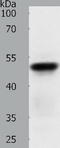 Acrosin antibody, TA323227, Origene, Western Blot image 