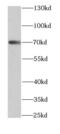 Rho GTPase Activating Protein 25 antibody, FNab00551, FineTest, Western Blot image 