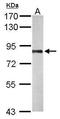 Polyribonucleotide Nucleotidyltransferase 1 antibody, TA308057, Origene, Western Blot image 