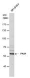 Serine/threonine-protein kinase PAK 1 antibody, PA5-29224, Invitrogen Antibodies, Western Blot image 