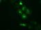 PKR2 antibody, NBP2-02520, Novus Biologicals, Immunocytochemistry image 
