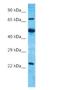 E3 ubiquitin-protein ligase MARCH7 antibody, NBP2-76664, Novus Biologicals, Western Blot image 