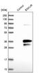 Enkurin, TRPC Channel Interacting Protein antibody, NBP1-89911, Novus Biologicals, Western Blot image 