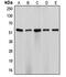 Cytochrome P450 Family 17 Subfamily A Member 1 antibody, MBS820246, MyBioSource, Western Blot image 
