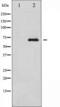 RELB Proto-Oncogene, NF-KB Subunit antibody, TA325808, Origene, Western Blot image 