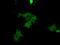 cGMP-dependent protein kinase 1 antibody, GTX83811, GeneTex, Immunocytochemistry image 