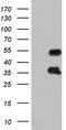 FosB Proto-Oncogene, AP-1 Transcription Factor Subunit antibody, CF804285, Origene, Western Blot image 