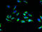 Potassium Voltage-Gated Channel Subfamily J Member 10 antibody, A56162-100, Epigentek, Immunofluorescence image 