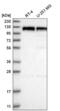 Discs Large MAGUK Scaffold Protein 2 antibody, NBP2-58558, Novus Biologicals, Western Blot image 