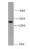 Histamine N-Methyltransferase antibody, FNab03944, FineTest, Western Blot image 