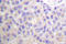 BCAR1 Scaffold Protein, Cas Family Member antibody, LS-C176545, Lifespan Biosciences, Immunohistochemistry frozen image 