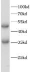 Egl-9 Family Hypoxia Inducible Factor 1 antibody, FNab10184, FineTest, Western Blot image 