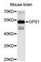 G Protein Pathway Suppressor 1 antibody, STJ23845, St John