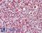 Replication Protein A2 antibody, LS-B11290, Lifespan Biosciences, Immunohistochemistry frozen image 