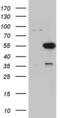 Pancreatic triacylglycerol lipase antibody, MA5-27514, Invitrogen Antibodies, Western Blot image 