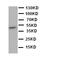 Mitogen-Activated Protein Kinase 8 antibody, LS-C313034, Lifespan Biosciences, Western Blot image 
