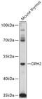 Diphthamide Biosynthesis 2 antibody, A12485, Boster Biological Technology, Western Blot image 