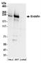 Zinc Finger FYVE-Type Containing 16 antibody, NBP2-36539, Novus Biologicals, Western Blot image 