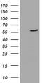 Cytochrome P450 Family 2 Subfamily A Member 6 antibody, TA504099, Origene, Western Blot image 