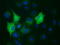 BUB1 Mitotic Checkpoint Serine/Threonine Kinase B antibody, M01564, Boster Biological Technology, Immunofluorescence image 