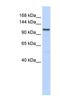 Adenylate Cyclase 8 antibody, NBP1-59027, Novus Biologicals, Western Blot image 